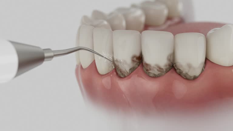 Reliable Dental contractor in Hurricane, WV by Dentist Open Now